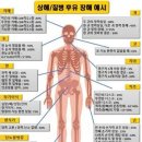 후유 이미지