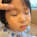 양산성모안과의원 | 아기 눈다래끼 병원 방문 후기 양산 증산성모안과의원