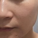 이슬처럼 | [이슬로이슬솝 후기] 투명 이슬처럼 녹아드는 아침세안법, 각질노폐물케어까지 확실했던 페이셜솝 사용기