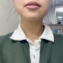에르고라인 | 쉐이피 브이라인밴드 에르고바디 EMS 리프팅밴드 내돈내산 후기