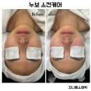누보스킨케어 이미지