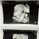 노블산부인과의원 이미지