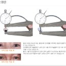 평화의안 | 의안제작 전문업체 평화의안연구소