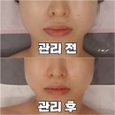 광안1-303 이미지