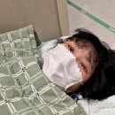 십자약국 | 30대 여자, 스키 타다 십자인대 파열 후 수술 후기