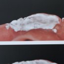 동행치과기공소 이미지