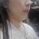 더바로한의원 | 부산 서면 한의원 튠페이스 이중턱 리프팅 2주차 솔직 후기