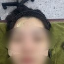 라라약국 | [대구/동구] 피부관리 에스테틱 라라샵 지묘점 후기