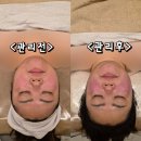 7324 | W.3 부산서면 예비신부관리잘하는곳 본리브에스테틱 솔직후기