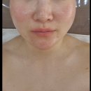 성미 | 일산 피부관리 피부가 환해지고 맑아지는 성미스킨케어 후기