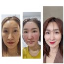 나이가 들면서 귀티나는 사람들의 특징 feat.인셀덤사용후기