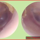 포낙보청기 남포센터 이미지