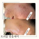 포미 이미지