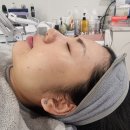 원포인트 콜드플라즈마 용산 | 용산 피부관리: 린다아이래쉬 콜드 플라즈마 & 물방울 리프팅 후기