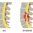 삼우 헬스 | 석촌고분역pt, 석촌pt,[라엘 헬스pt] 신규 회원 척추관협착증 상담 후기