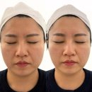더라인핏 | 이수역 피부관리 추천 인더뷰티 페이스핏톡스 후기 얼굴라인 관리 만족
