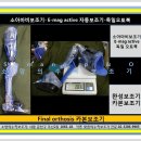 소망의수족보조기 Daum카페
