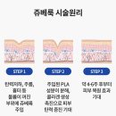 청아연의원 | [피부관리] 트리플 부스터 패키지 (포텐자+쥬베룩스킨+쥬베룩볼륨후기 (+시술 초기 부작용)