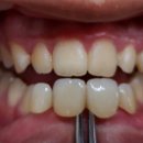 앤기공소 이미지