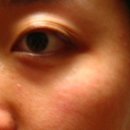 스킨트리 이미지