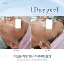 구산피부관리실 네이버블로그