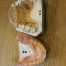 명치과기공소 이미지