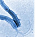 [건강 칼럼] 위장관 질환과 헬리코박터 균 - 비타민C박사 서울대 이왕재교수 이미지