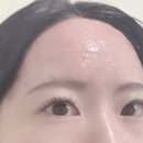 희헤어라인 이미지