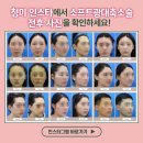 청미광고 이미지