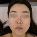 올가코스메틱 | 신정동피부관리 잘하는 곳 올가드림뷰티 목동신정점 초음파리프팅 wave 관리 후기