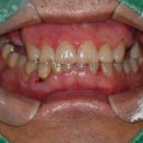 가든치과의원 | 반포역치과? 과잉진료 피하려면 &#39;이것&#39;은 알고 계십시오