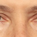 스누성형외과의원 이미지