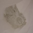 남구-35 | 울산 남구 에스테틱 임산부 출산 4개월 후 비만 셀룰라이트 다이어트 복부슬리밍 한 찐 후기