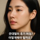 태인한의원 | 콧대필러 후기 퍼짐없이 유지하고싶다면 주목!