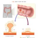 중앙항외과의원 네이버블로그