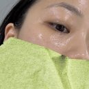 웨딩/신부 관리 청라 비쥬에스테틱 윤곽케어 후기