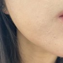 쌩얼스킨케어 | [광주 주월동 피부관리] 미백과 탄력에 효과적인 플라즈마관리, 물빛스킨케어(후기 리뷰까지)