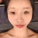 대구 예신 경락 맛집 | 라플러스에스떼 솔직후기