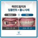 오송미소치과의원 | 오송치과, 다시 씹는 즐거움을 찾아드립니다