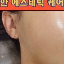 서현피부