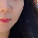 마산여드름관리 건조한피부 홍조관리 치유은애에스테틱 / 마산문제성피부 전문 끝판왕