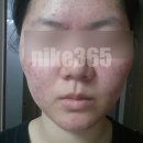 특별한 한의원 | 여드름 한의원 후기, '진단' 하나로 피부가 바뀔 수 있을까요?