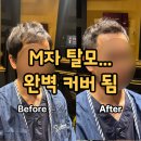 주차30 | 명일동미용실 하이드아웃 바버샵, M자 탈모 고민 해결하고 온 후기