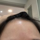 PC1004 | [일산 피부관리]골근윤곽+피부관리 한번에💆‍♀️ 수소테라피 후기 <살롱드보떼 본점>