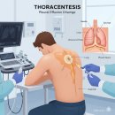 별천자 | 흉강천자 시술, 꼭 알아야 할 핵심 정보