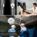 십자인대파열수술 정밀한 진단부터 만족 높은 결과까지 이미지