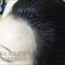 렉스헤어라인