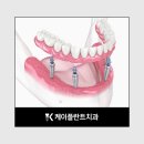 엑스올디자인 이미지