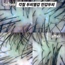 서창남로 40(상가건물 앞) | 대구두피관리 40대 워킹맘 머리 냄새 답답함 때문에 받아본 방문후기