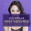 어린공주성형외과의원 이미지